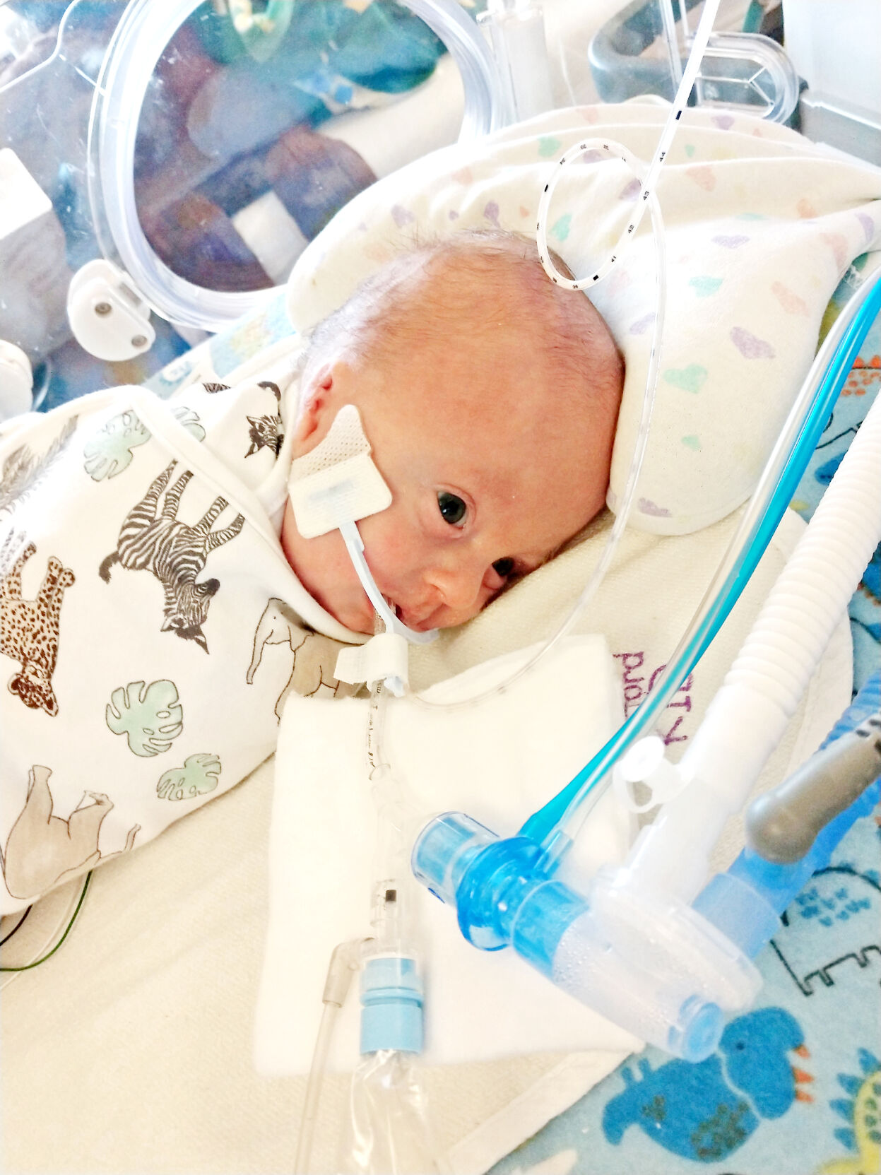 Sylas Gengler on ventilator